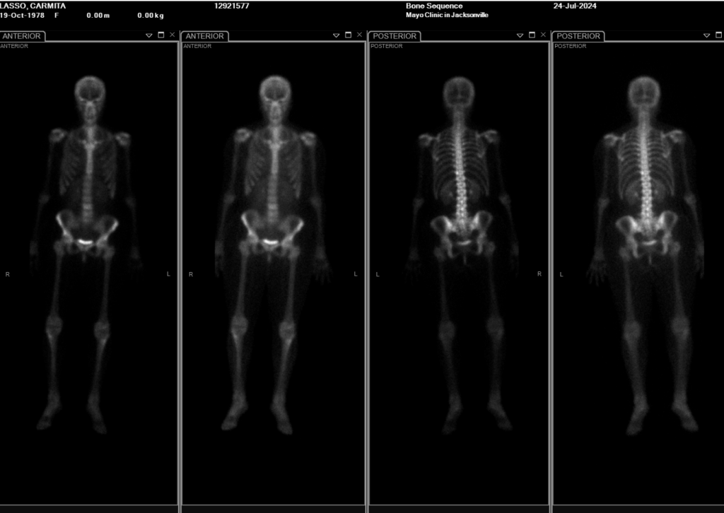 Once again on the merry go&nbsp;round.