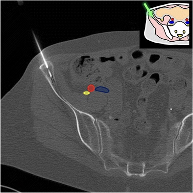 Back to the drawing&nbsp;board